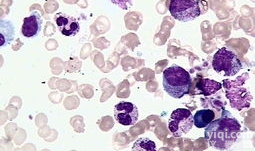 小鼠<em>肾小球</em><em>内皮</em>细胞完全<em>培养基</em>厂家