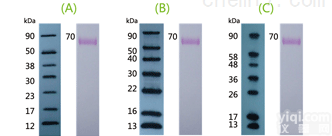 M201  Exposure <em>Marker</em><em>曝光</em>标记
