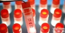 FD6<em>细胞</em>,人淋巴<em>细胞</em>与<em>仓鼠</em>肺<em>细胞</em>杂交<em>细胞</em>