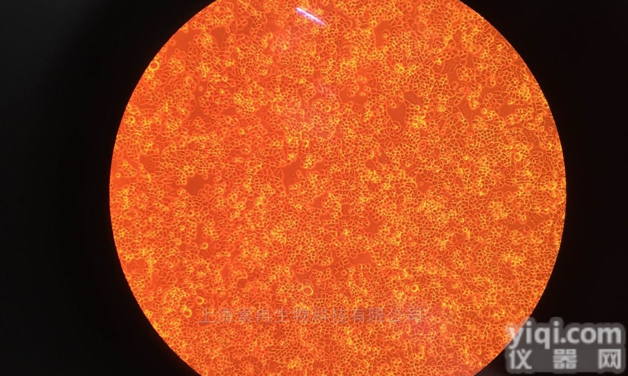 CNE-1/14 人<em>鼻咽癌</em>/DDP <em>耐药</em>细胞