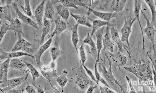 NK92MI人恶性非<em>霍奇金</em><em>淋巴瘤</em>的自然杀伤<em>细胞</em>