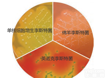 M1924  <em>显色</em><em>培养基</em>--单增<em>李斯特</em>菌快速鉴别琼脂