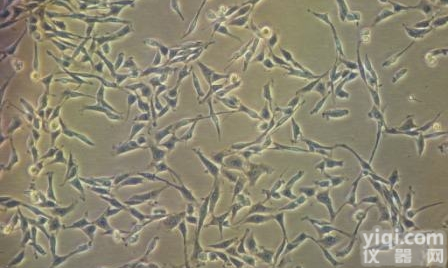 人<em>膀胱</em><em>癌细胞</em>，BT-B厂家<em>图片</em>来源