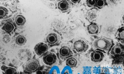 细胞<em>程序性</em><em>坏死</em>整体实验