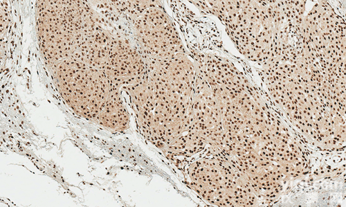 SPC-742D  α-突触<em>核蛋白</em> （<em>磷酸化</em>Ser129） 抗体