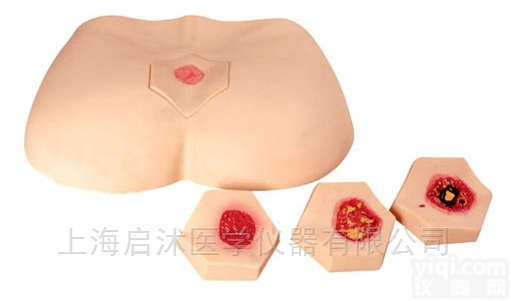 QS/H90F  <em>阶段</em><em>褥疮</em><em>护理模型</em>