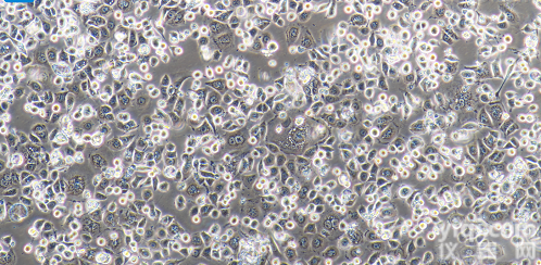 <em>AGS</em>  <em>AGS</em> 人<em>胃腺</em><em>癌细胞</em>（STR鉴定）