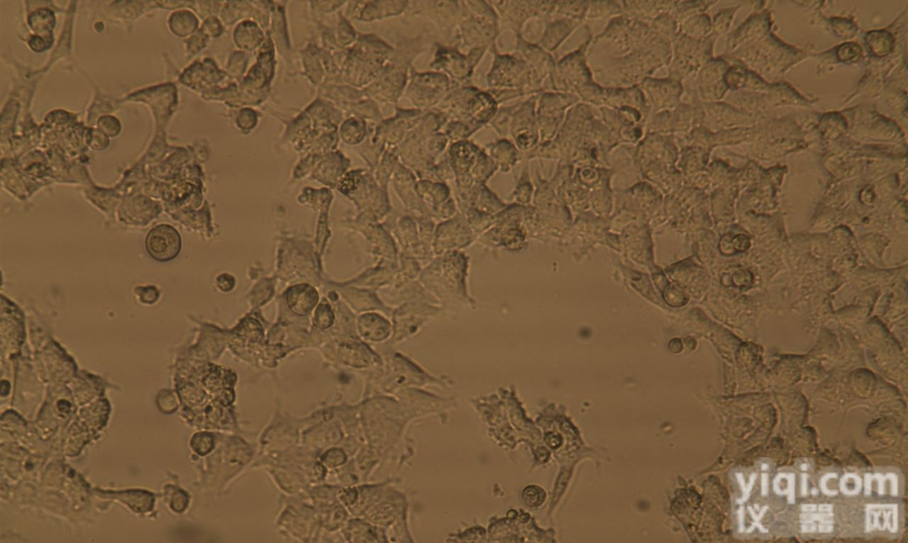 MCF7/Adr人<em>乳腺癌</em>阿霉素<em>耐药</em>株 含STR<em>鉴定</em>