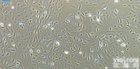 PL45  PL45 人导管<em>腺癌</em>细胞/STR<em>鉴定</em>