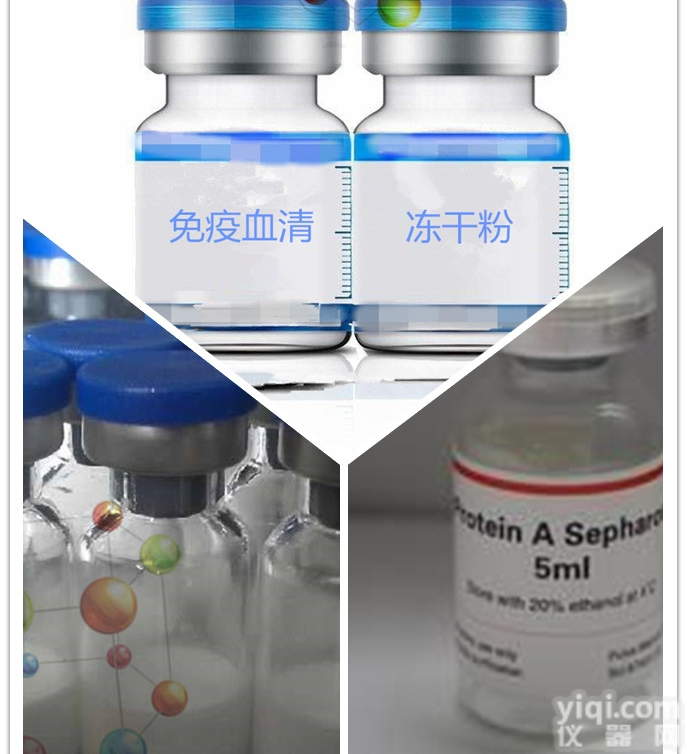 兔抗<em>甲胎蛋白</em>（AFP）血清<em>现货</em>供应