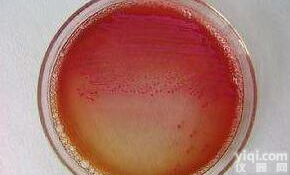 CMCC 44102 <em>冻干</em>粉  <em>大肠</em>埃希氏菌