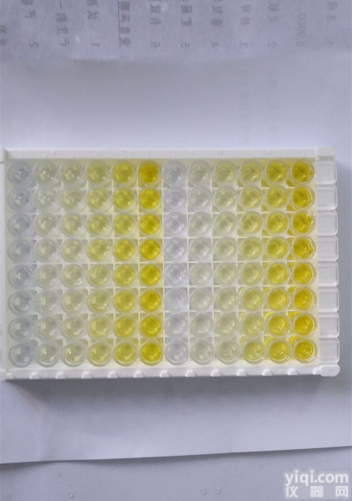 大鼠<em>泰泽</em><em>病原体</em>（Tyzzer）ELISA<em>试剂盒</em>