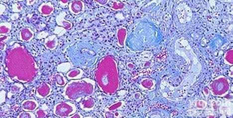 乳酸脱氢酶<em>同工</em>酶I（LDH1）<em>质控</em>品 长期供应