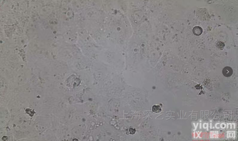 SW-13人肾上腺皮质小细胞<em>癌细胞</em> 含STR<em>鉴定</em>