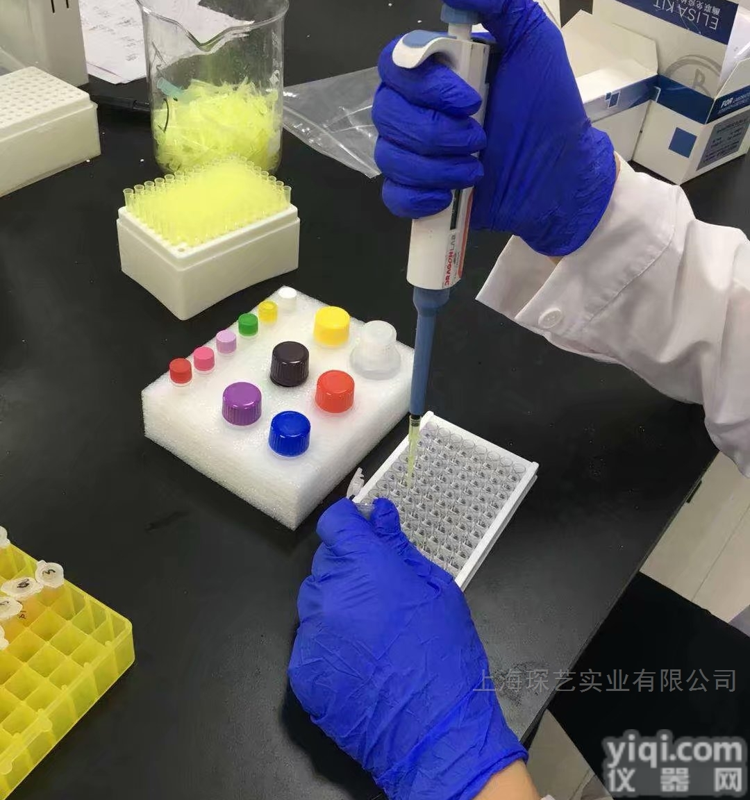 小鼠细胞<em>周期</em>素（<em>Cyclin</em>-<em>D1</em>）ELISA试剂盒价格