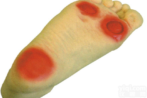 KAH-HS19  高级<em>糖尿病足</em><em>护理模型</em>2