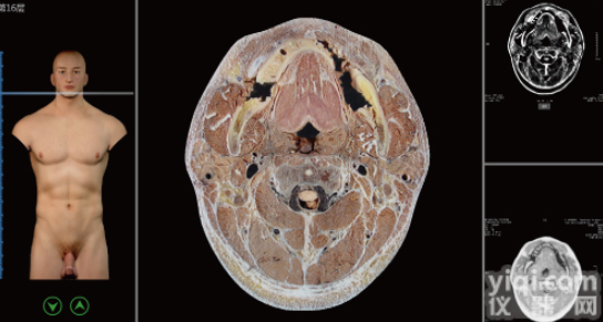 KAH-P901  <em>断层</em>解剖与<em>断层</em>影像虚拟教学系统