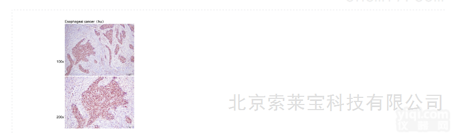 K106790P  Anti-<em>IQGAP1</em> Polyclonal <em>Antibody</em>