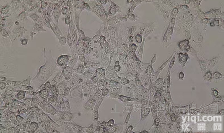 NCI-H1385人非小<em>细胞</em><em>肺癌</em><em>细胞</em> 通过STR<em>鉴定</em>