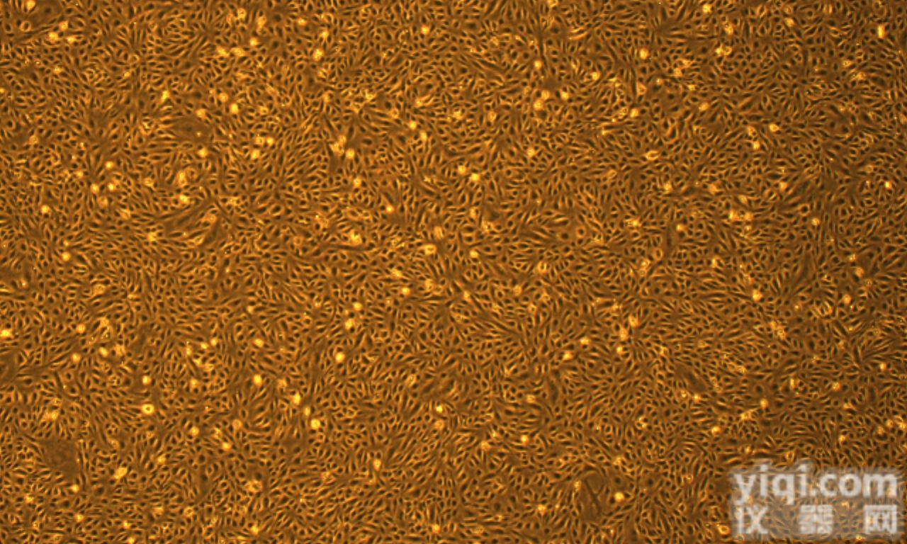 HUM-CELL-0001  原代<em>细胞</em> 人肺微<em>血管</em><em>内皮</em><em>细胞</em>