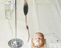 <em>婴儿</em><em>头部</em>注射<em>模型</em>，小儿头皮静脉穿刺训练<em>模型</em>