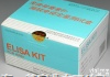 <em>现货供应</em>       人转录<em>因子</em><em>抗体</em>-1(ATF-1)Elisa试剂盒