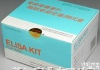 Y11060A   Elisa<em>试剂盒</em>  (KLR)人<em>杀伤</em><em>细胞</em>凝集素样受体