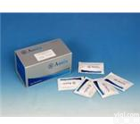 Y11063A   Elisa<em>试剂盒</em>  (FHA)人丝狀<em>血球</em><em>凝集</em>素