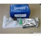 Y11077A   Elisa<em>试剂盒</em>  (OGP)人<em>成骨</em><em>生长</em>肽