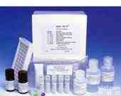 人的<em>髓鞘</em><em>脂蛋白</em>脂质蛋白1(PLP1)酶联免疫吸附测定试剂盒