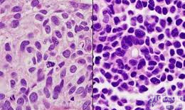 Anti-Frizzled 1/<em>Wnt</em> receptor  <em>Wnt</em><em>信号</em>受体蛋白抗体