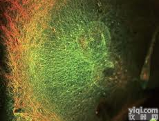 Anti-MCC  <em>大肠癌</em>肿瘤<em>突变</em>蛋白<em>抗体</em>