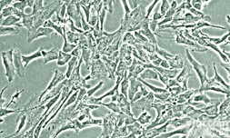 Anti-ASM/Acid sphingomyelinase  <em>酸性</em>神经鞘<em>磷脂</em>酶<em>抗体</em>