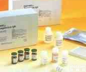 人白色<em>念珠</em>菌Elisa<em>试剂盒</em>价格,(C.albicans)Elisa<em>试剂盒</em>Kit说明书