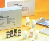 <em>小鼠</em>促<em>生长激素</em>释放激素ELISA<em>试剂盒</em>价格,(GHRH）Elisa<em>试剂盒</em>Kit说明书