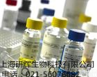 人细菌性阴道病快速检测<em>试剂盒</em>(BV)ELISA<em>试剂盒</em>上海<em>科研</em>网