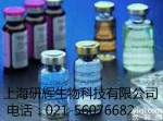 人α-L-<em>岩藻糖</em>苷酶（AFU）ELISA Kit   <em>价格</em>