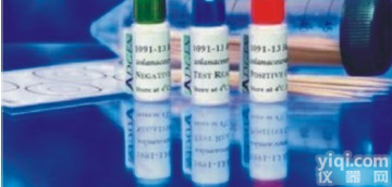 <em>突触</em>相关<em>蛋白</em>-1/<em>突触</em>素<em>抗体</em>