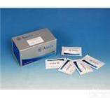 大鼠角化细胞内分泌因子<em>说明书</em>(KAF)|双调蛋白<em>说明书</em>(AR)Elisa<em>试剂盒</em><em>价格</em>