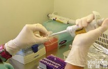 人皮肤T细胞<em>虏获</em><em>趋化</em>因子(CTACK/CCL27)ELISA<em>试剂盒</em> 价格