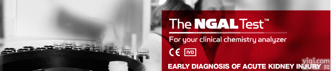 人免疫球蛋白G Fc段<em>受体</em>Ⅰ(FcγRⅠ/CD64)ELISA<em>试剂盒</em> G Fc段<em>受体</em>Ⅰ(FcγRⅠ/CD64)ELISA<em>试剂盒</em>