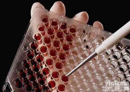 <em>β-N-乙酰氨基葡萄糖苷酶测试盒/NAG测试盒</em>