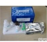 (angiostatin)人<em>血管</em>抑素/<em>血管</em>稳定蛋白Elisa试剂盒