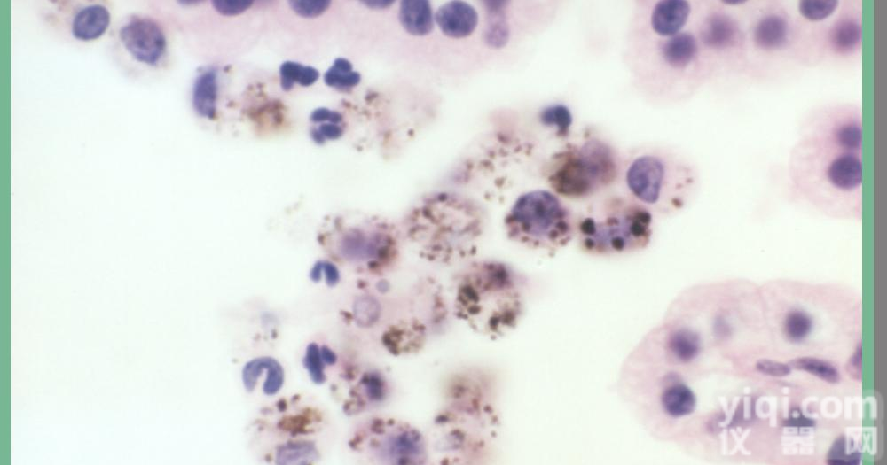 VERO C1008 E6非洲绿猴肾<em>细胞</em>ATCC<em>代理</em>，<em>细胞</em>价格优惠 