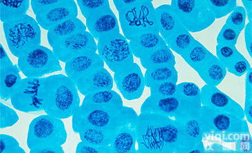 NCI-H446小<em>细胞</em>ATCC厂商代理<em>细胞</em><em>价格优惠</em>肺癌<em>细胞</em>ATCC厂商代理<em>细胞</em><em>价格优惠</em>