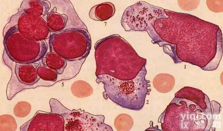 CaLu-3人肺腺癌细胞ATCC厂商代理细胞<em>价格优惠</em> 