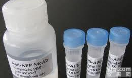 乙酰化组蛋白<em>H2B</em><em>抗体</em>，Acetyl-<em>Histone</em> <em>H2B</em>(K20)，Acetyl-<em>Histone</em> <em>H2B</em>(K20)<em>抗体</em>