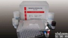 人促分裂素原活化蛋白<em>激酶</em>激活的蛋白<em>激酶</em>3(MAPKAPK3)ELISA<em>试剂盒</em>(酶联<em>检测</em>)