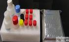 人<em>血清</em>/糖皮质激素调节<em>激酶</em>2(GSK2)ELISA<em>试剂盒</em>价格，人ELISA<em>试剂盒</em>说明书