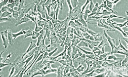 <em>SPC</em>-A1<em>细胞</em>，人<em>肺癌</em><em>细胞</em>